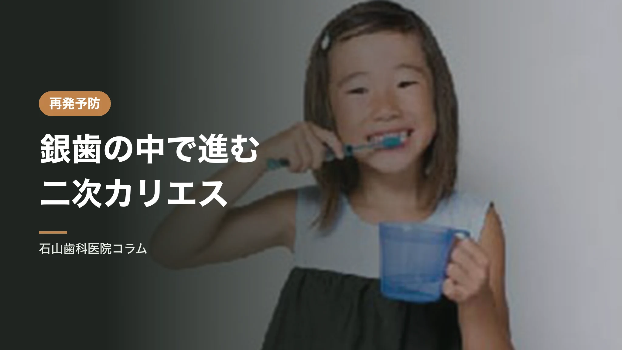 銀歯の中で進む二次カリエスと、削る量が増える悪循環