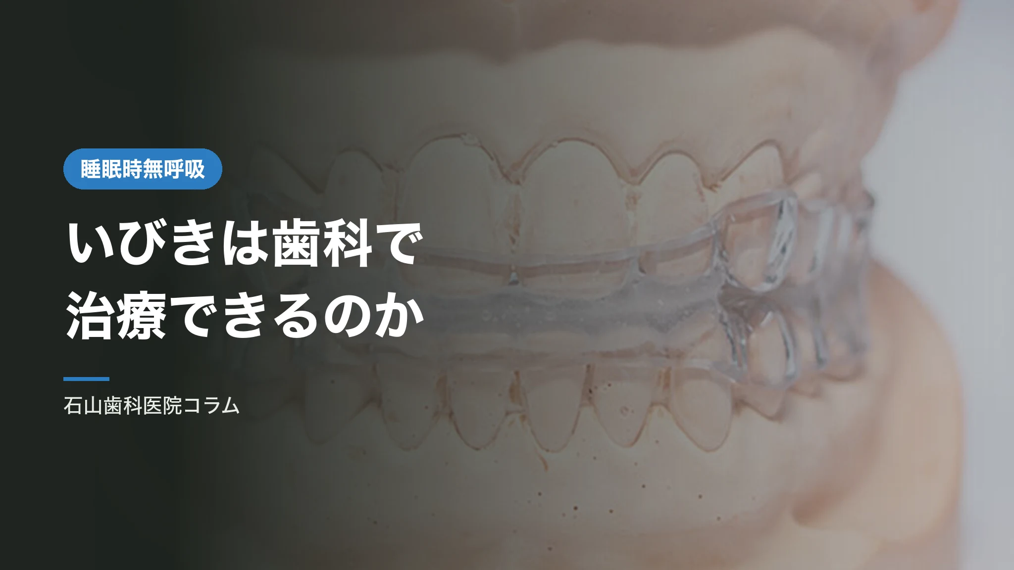 いびきは歯科で治療できるのか|口腔内装置という選択肢